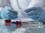 Wybuch epidemii Eboli w DR Kongo zabija 65 os&oacute;b, z czego zgłoszono 246 przypadk&oacute;w